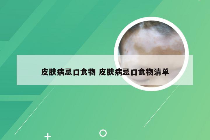 皮肤病忌口食物 皮肤病忌口食物清单