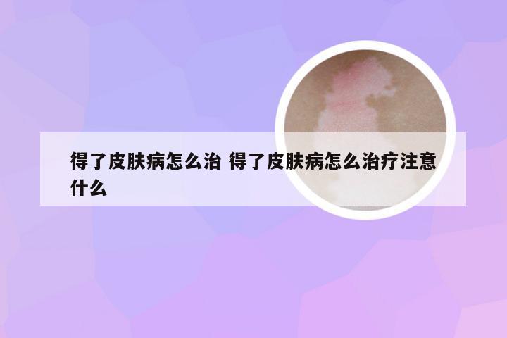 得了皮肤病怎么治 得了皮肤病怎么治疗注意什么