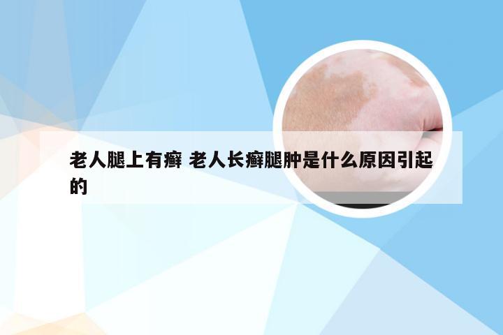 老人腿上有癣 老人长癣腿肿是什么原因引起的
