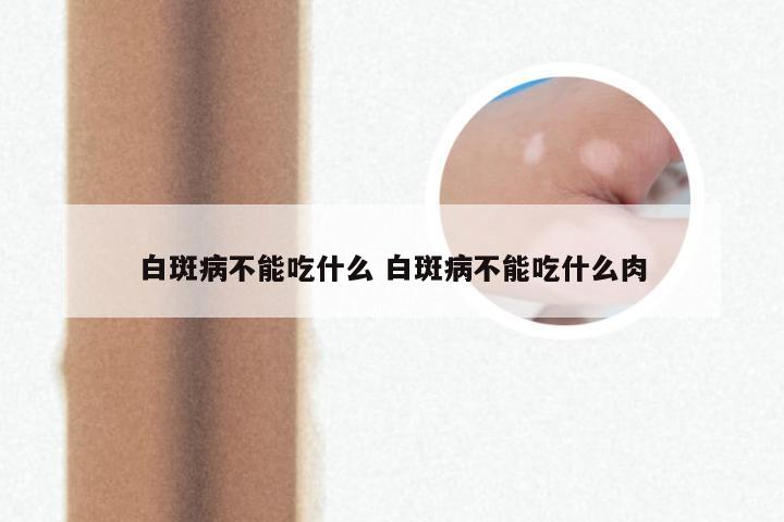 白斑病不能吃什么 白斑病不能吃什么肉