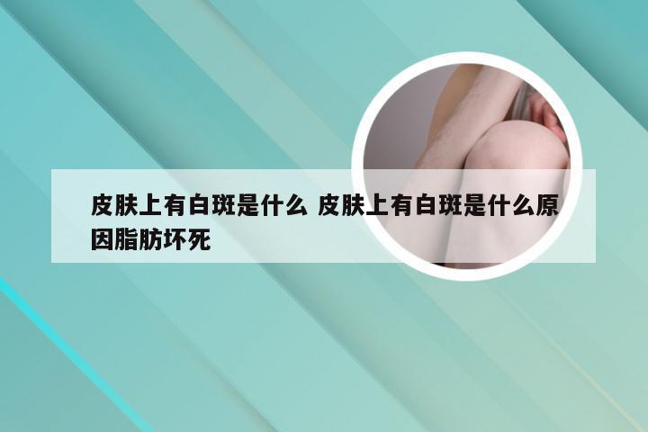 皮肤上有白斑是什么 皮肤上有白斑是什么原因脂肪坏死