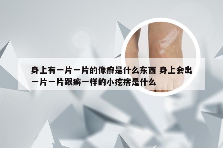身上有一片一片的像癣是什么东西 身上会出一片一片跟癣一样的小疙瘩是什么