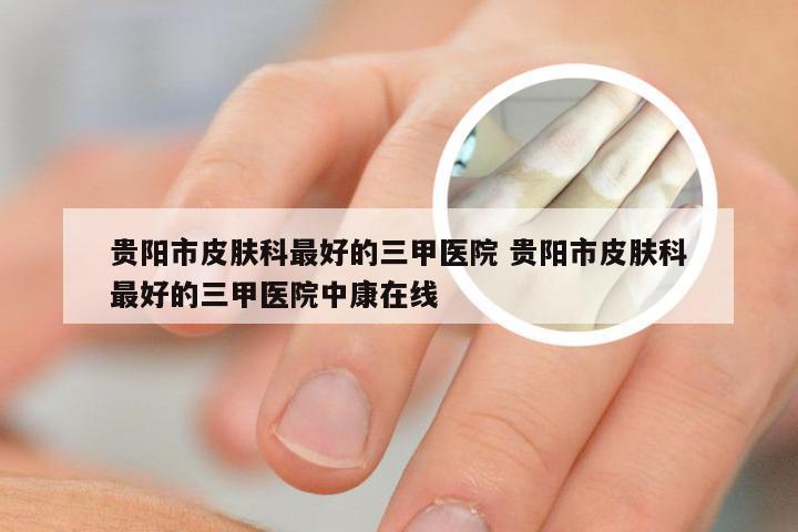贵阳市皮肤科最好的三甲医院 贵阳市皮肤科最好的三甲医院中康在线
