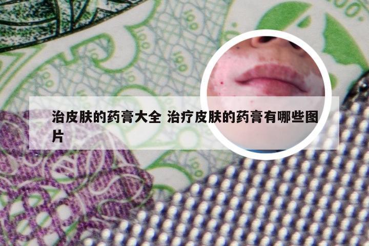 治皮肤的药膏大全 治疗皮肤的药膏有哪些图片