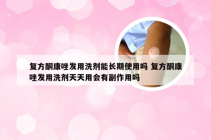 复方酮康唑发用洗剂能长期使用吗 复方酮康唑发用洗剂天天用会有副作用吗