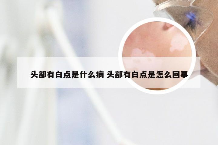 头部有白点是什么病 头部有白点是怎么回事