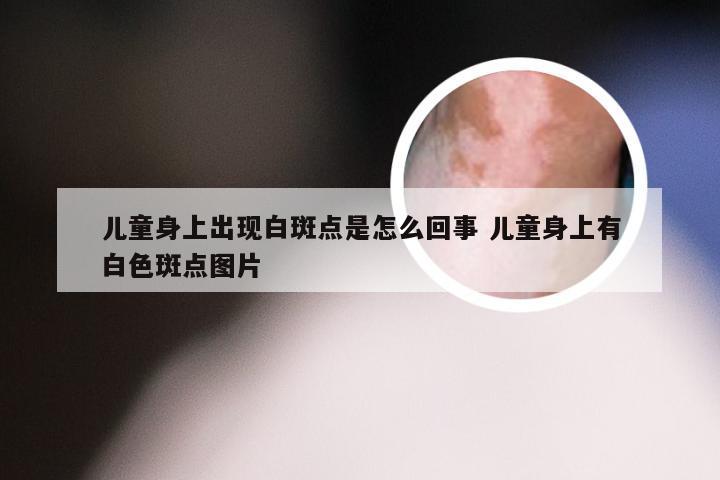儿童身上出现白斑点是怎么回事 儿童身上有白色斑点图片