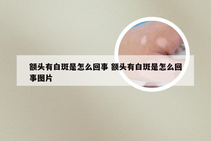 额头有白斑是怎么回事 额头有白斑是怎么回事图片