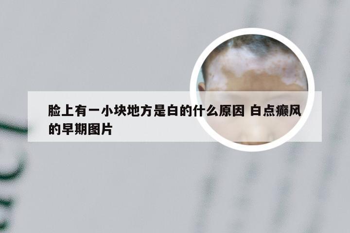 脸上有一小块地方是白的什么原因 白点癫风的早期图片
