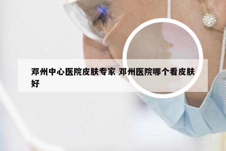 邓州中心医院皮肤专家 邓州医院哪个看皮肤好