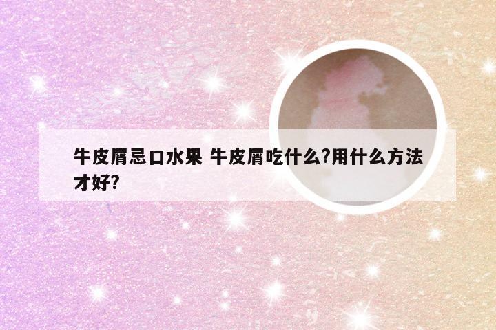 牛皮屑忌口水果 牛皮屑吃什么?用什么方法才好?