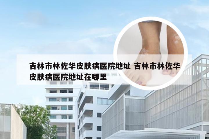 吉林市林佐华皮肤病医院地址 吉林市林佐华皮肤病医院地址在哪里