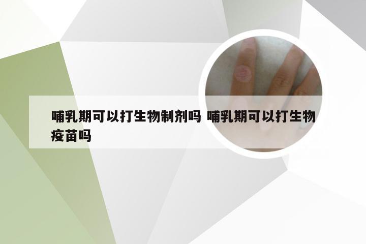 哺乳期可以打生物制剂吗 哺乳期可以打生物疫苗吗