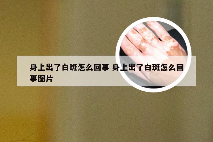 身上出了白斑怎么回事 身上出了白斑怎么回事图片