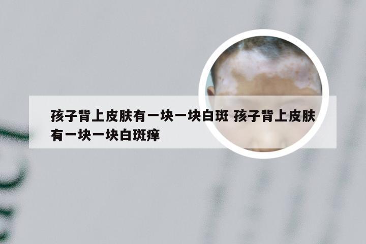 孩子背上皮肤有一块一块白斑 孩子背上皮肤有一块一块白斑痒