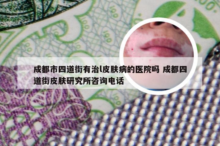 成都市四道街有治l皮肤病的医院吗 成都四道街皮肤研究所咨询电话