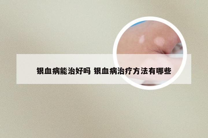 银血病能治好吗 银血病治疗方法有哪些