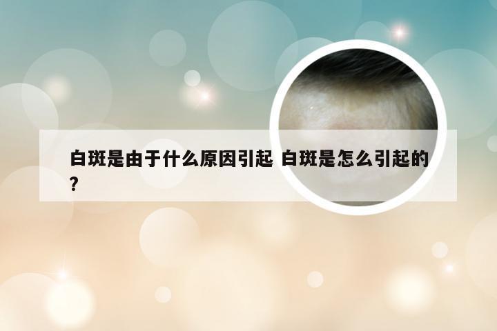 白斑是由于什么原因引起 白斑是怎么引起的?