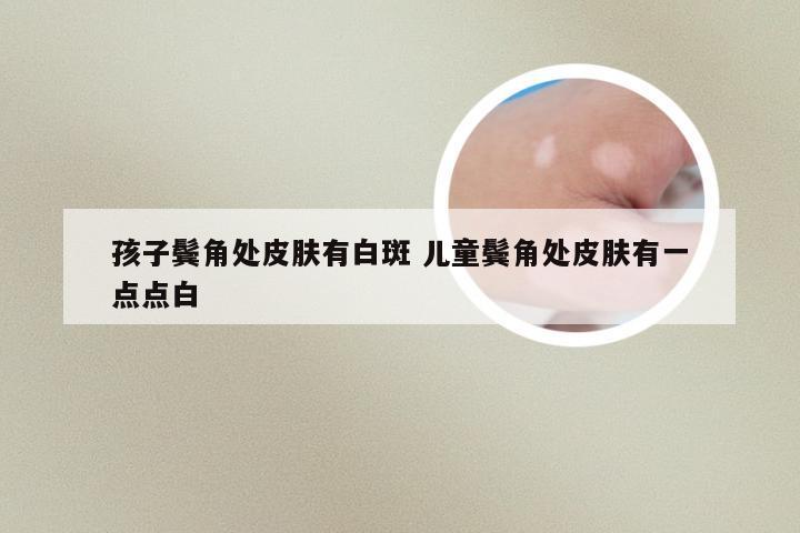 孩子鬓角处皮肤有白斑 儿童鬓角处皮肤有一点点白