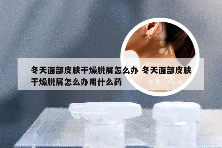 冬天面部皮肤干燥脱屑怎么办 冬天面部皮肤干燥脱屑怎么办用什么药