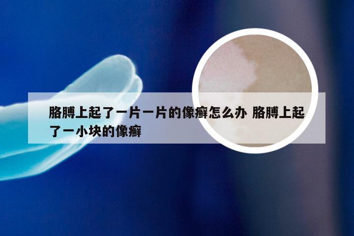 胳膊上起了一片一片的像癣怎么办 胳膊上起了一小块的像癣