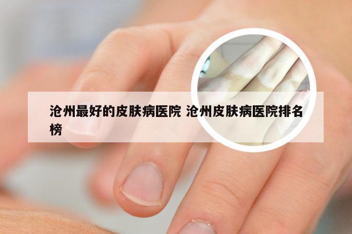 沧州最好的皮肤病医院 沧州皮肤病医院排名榜
