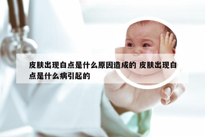 皮肤出现白点是什么原因造成的 皮肤出现白点是什么病引起的