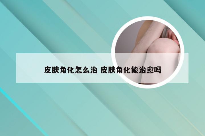 皮肤角化怎么治 皮肤角化能治愈吗