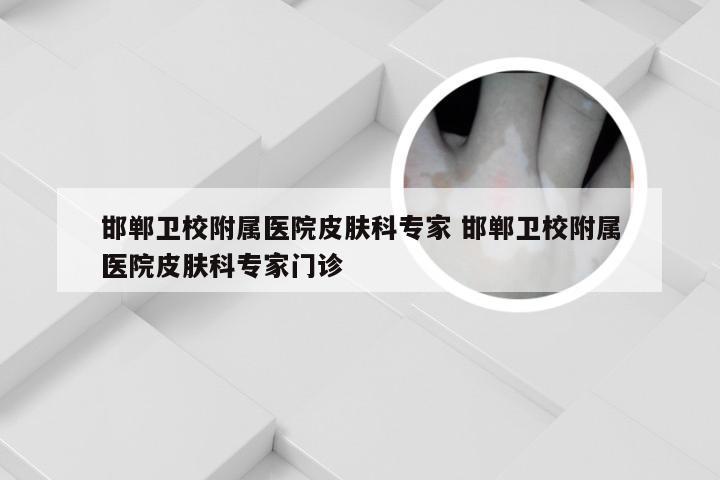 邯郸卫校附属医院皮肤科专家 邯郸卫校附属医院皮肤科专家门诊