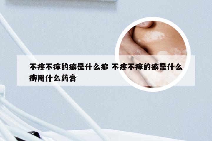 不疼不痒的癣是什么癣 不疼不痒的癣是什么癣用什么药膏