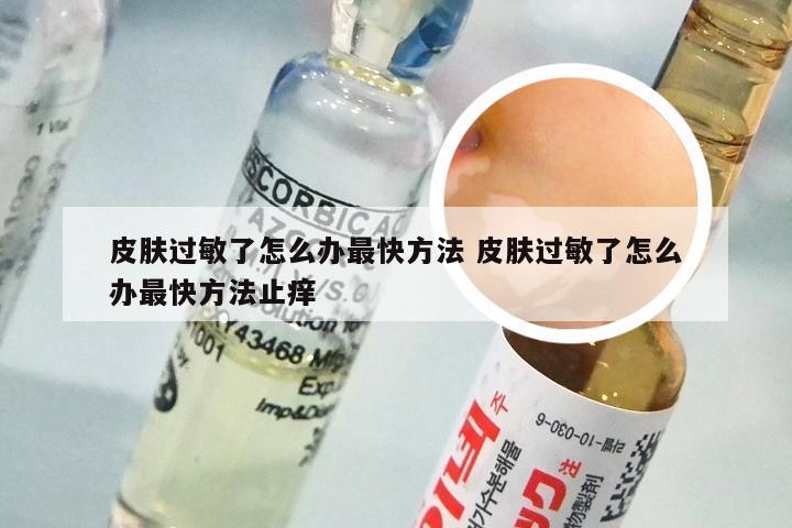 皮肤过敏了怎么办最快方法 皮肤过敏了怎么办最快方法止痒