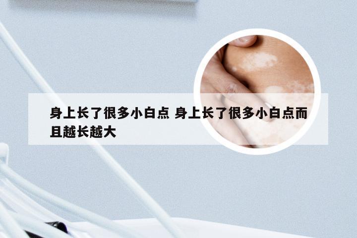 身上长了很多小白点 身上长了很多小白点而且越长越大