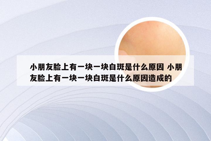 小朋友脸上有一块一块白斑是什么原因 小朋友脸上有一块一块白斑是什么原因造成的
