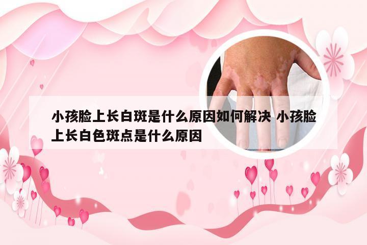 小孩脸上长白斑是什么原因如何解决 小孩脸上长白色斑点是什么原因