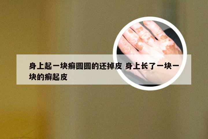 身上起一块癣圆圆的还掉皮 身上长了一块一块的癣起皮