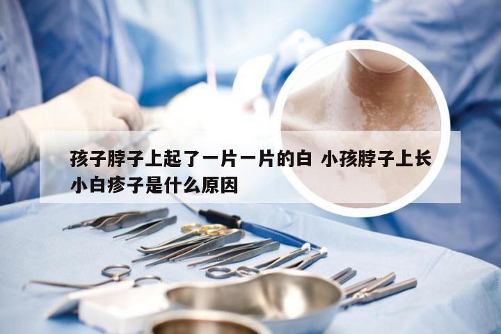 孩子脖子上起了一片一片的白 小孩脖子上长小白疹子是什么原因