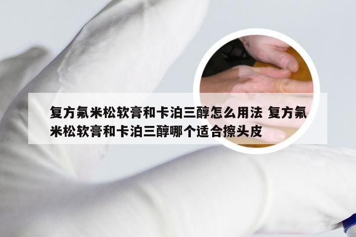 复方氟米松软膏和卡泊三醇怎么用法 复方氟米松软膏和卡泊三醇哪个适合擦头皮