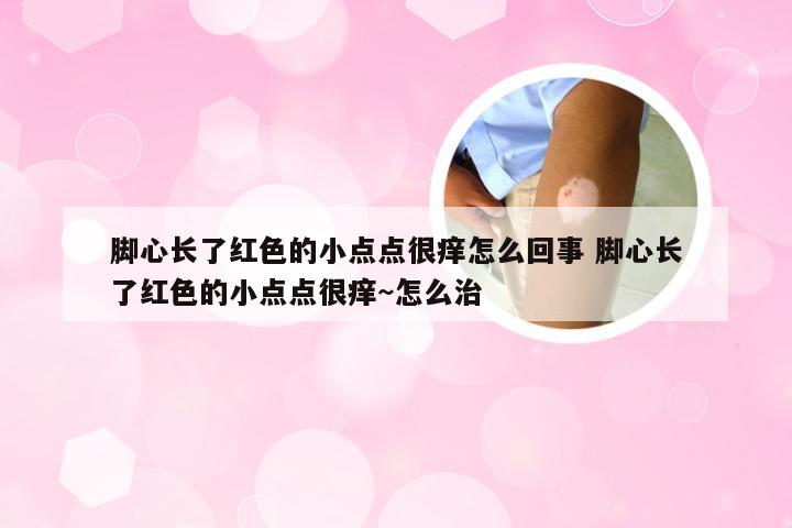 脚心长了红色的小点点很痒怎么回事 脚心长了红色的小点点很痒~怎么治