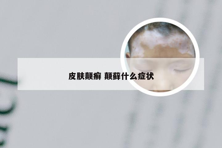 皮肤颠癣 颠藓什么症状