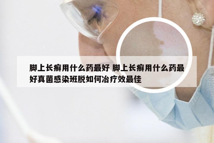 脚上长癣用什么药最好 脚上长癣用什么药最好真菌感染班脱如何冶疗效最佳