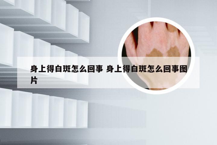 身上得白斑怎么回事 身上得白斑怎么回事图片
