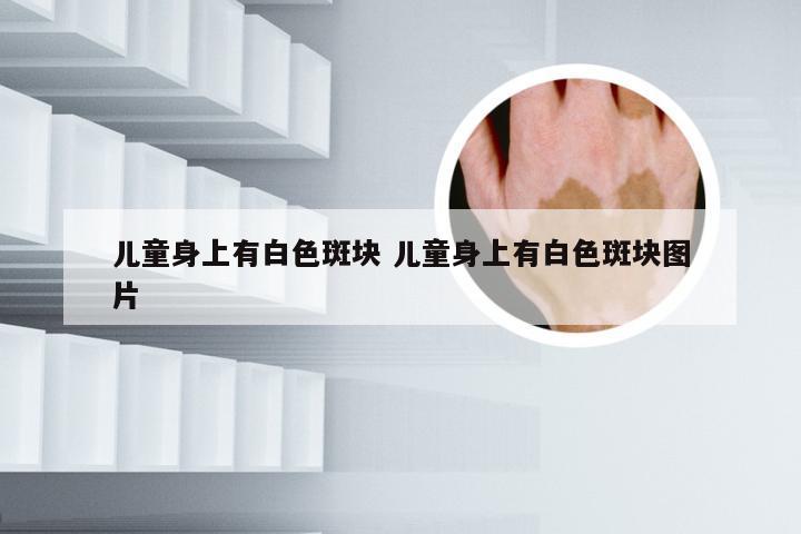 儿童身上有白色斑块 儿童身上有白色斑块图片