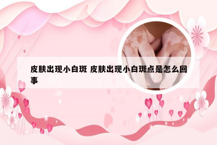 皮肤出现小白斑 皮肤出现小白斑点是怎么回事
