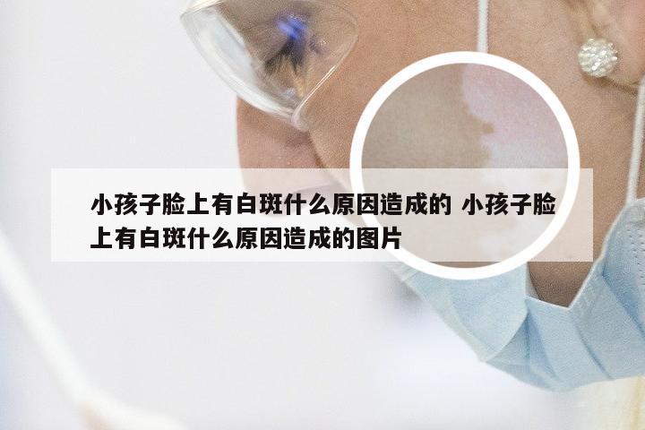 小孩子脸上有白斑什么原因造成的 小孩子脸上有白斑什么原因造成的图片