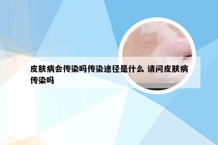 皮肤病会传染吗传染途径是什么 请问皮肤病传染吗