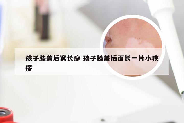 孩子膝盖后窝长癣 孩子膝盖后面长一片小疙瘩