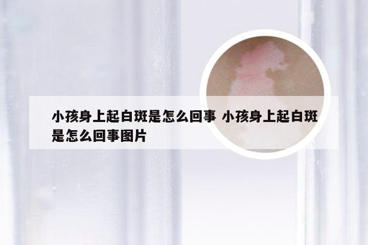 小孩身上起白斑是怎么回事 小孩身上起白斑是怎么回事图片