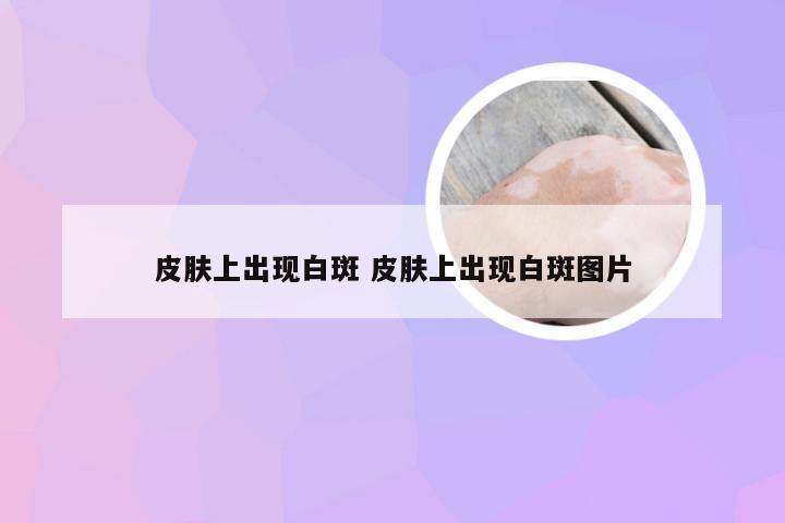 皮肤上出现白斑 皮肤上出现白斑图片