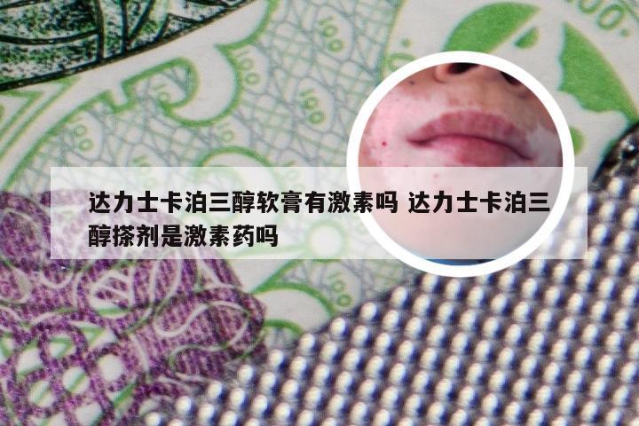 达力士卡泊三醇软膏有激素吗 达力士卡泊三醇搽剂是激素药吗