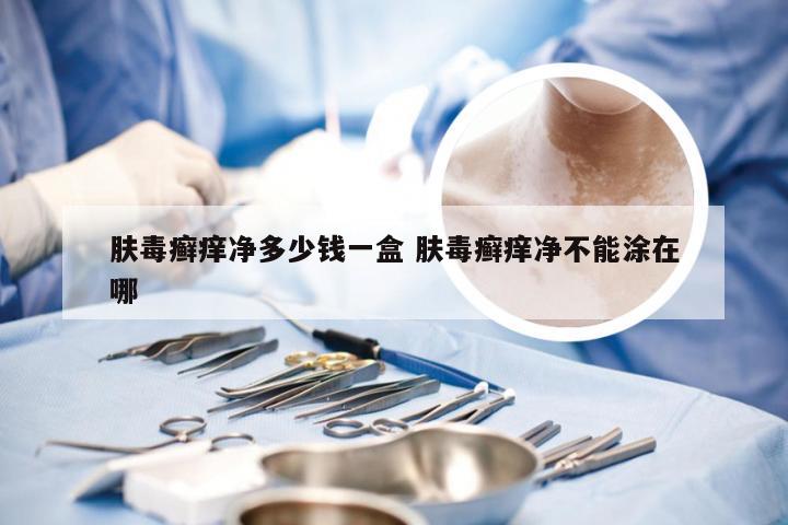 肤毒癣痒净多少钱一盒 肤毒癣痒净不能涂在哪